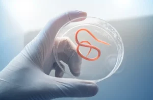 Can a Colonoscopy Detect Parasites
