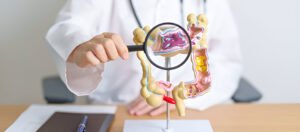 How do you get Crohn's disease