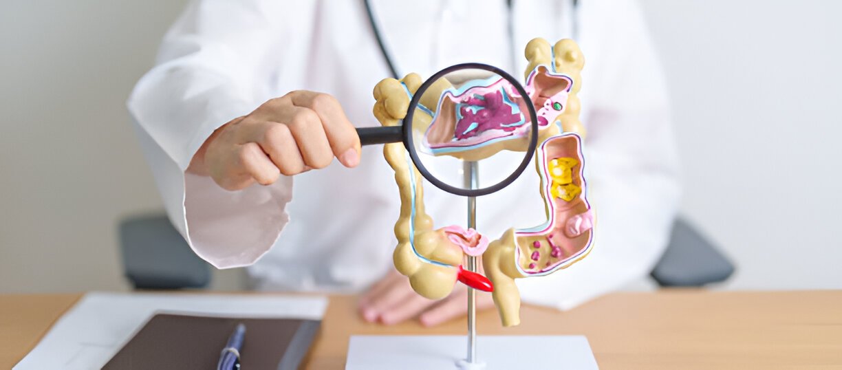 How do you get Crohn's disease